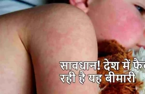 भारत पर मंडरा रहा इस खतरनाक बीमारी का खतरा, WHO ने जारी की चेतावनी