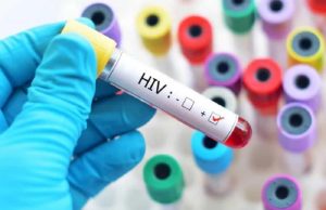 Chandigarh में HIV मामलों में बढ़ोतरी, अभी तक 35 लोगों की जा चुकी है जान