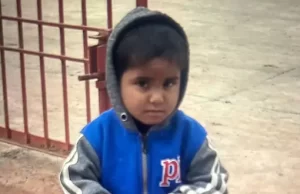 Ludhiana में 3 साल की मासूम पर कुत्ते ने किया हमला: सिर और चेहरा बुरी तरह जख्मी, 35 टांके लगे; घर के बाहर खेल रही थी बच्ची